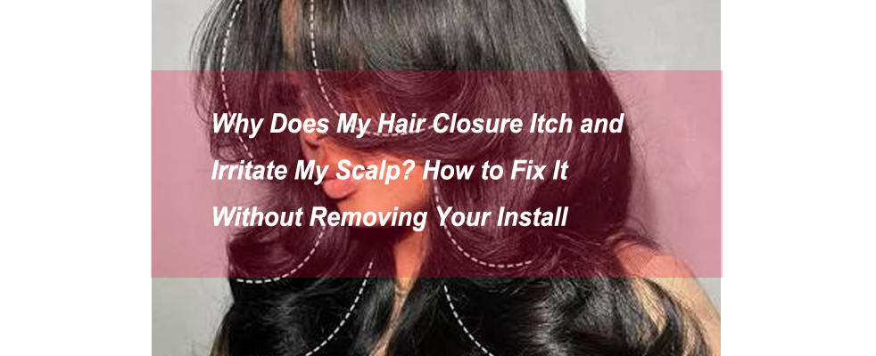 Why Does My Hair Closure Itch and Irritate My Scalp? How to Fix It Without Removing Your Install